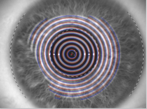 Qué se diferencia entre la ortoqueratología y los métodos tradicionales de corrección visual?